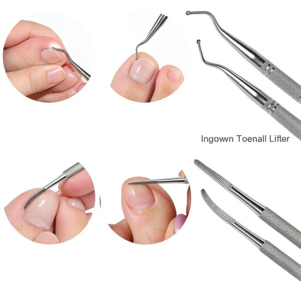 Ingrown Toenail Kit SMZHealing Stainless Steel-5