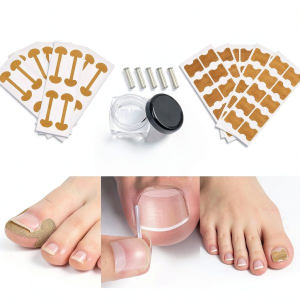 Ingrown Nail Kit Yutlei Professional Tool-5