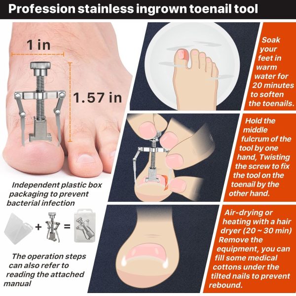 Konovo Ingrown Toenail Kit Heavy Duty Stainless-2