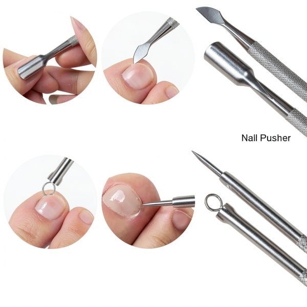 Ingrown Toenail Kit SMZHealing Stainless Steel-6
