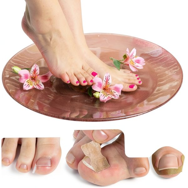 Ingrown Toenail Correction Kit by Honyjooy-4