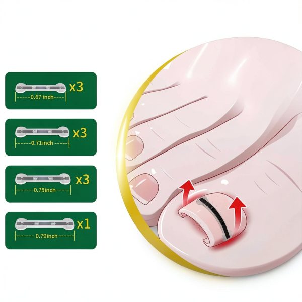 Ingrown Toenail Corrector Fuzzycare Memory Patch-5